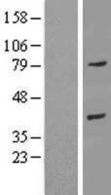 Western Blot: Annexin A9 Overexpression Lysate [NBL1-07568]