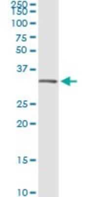 Immunoprecipitation: Annexin V Antibody (1F4-1A5) [H00000308-M01]