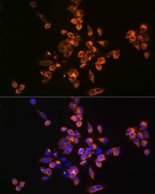 Immunocytochemistry/ Immunofluorescence: Annexin V Antibody - BSA Free [NBP2-92940]