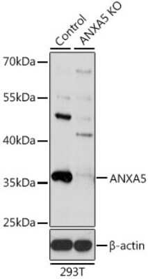 Knockout Validated: Annexin V Antibody - BSA Free [NBP2-92940]