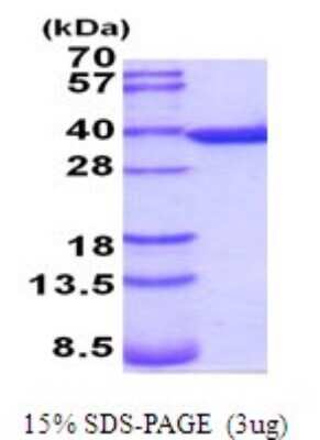 SDS-PAGE: Recombinant Mouse Annexin V His Protein [NBP2-52063]