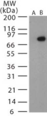 Western Blot: Anthrax PA Antibody [NB100-56670]