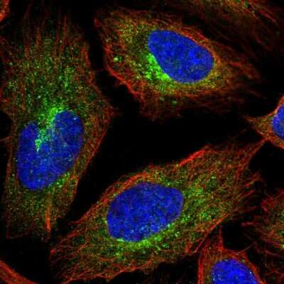 Immunocytochemistry/ Immunofluorescence: Apc1 Antibody [NBP2-37901]