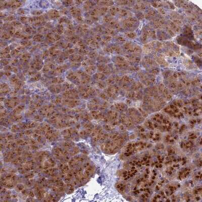 Immunohistochemistry-Paraffin: Apc1 Antibody [NBP2-37901]