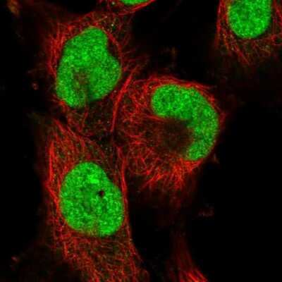 Immunocytochemistry/ Immunofluorescence: Apc11 Antibody [NBP1-90139]