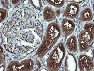 Immunohistochemistry: Apc11 Antibody (OTI3F5) - Azide and BSA Free [NBP2-71939]