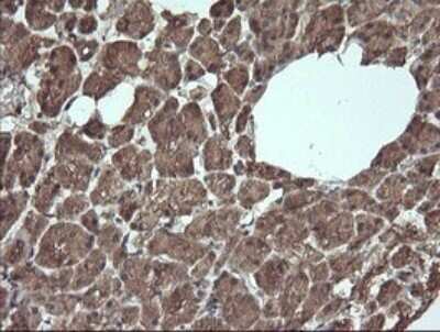 Immunohistochemistry: Apc11 Antibody (OTI3F5) - Azide and BSA Free [NBP2-71939]