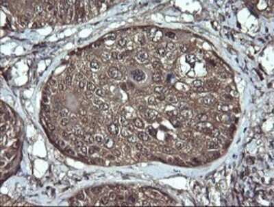 Immunohistochemistry: Apc11 Antibody (OTI3F5) [NBP2-45493]