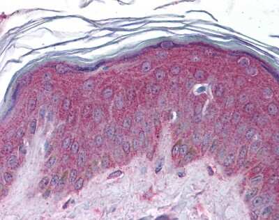 Immunohistochemistry: Apc2 Antibody [NBP2-87013]