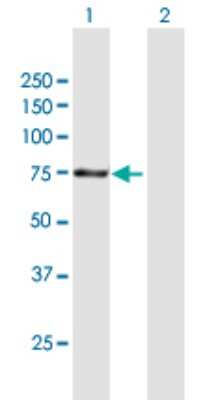 Western Blot: Apc5 Antibody [H00051433-B01P]