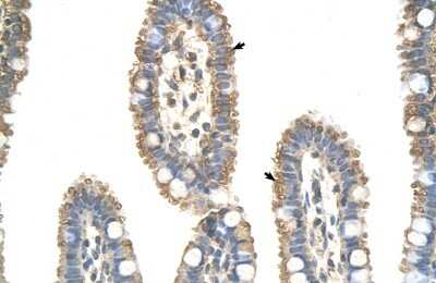 Immunohistochemistry-Paraffin: Apc7 Antibody [NBP1-58224]