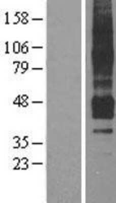 Western Blot: APJ/Apelin receptor Overexpression Lysate [NBL1-07606]