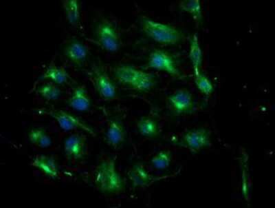 Immunocytochemistry/ Immunofluorescence: ATG3/APG3 Antibody (OTI3H2) [NBP2-01083]