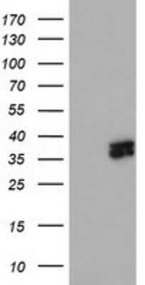 Western Blot: ATG3/APG3 Antibody (OTI3H2) [NBP2-01083]
