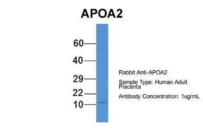 Western Blot: Apolipoprotein A-II/ApoA2 Antibody [NBP1-57716]