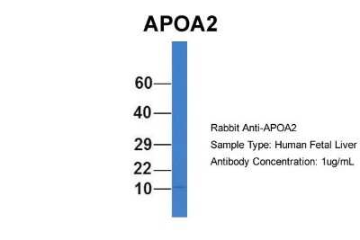 Western Blot: Apolipoprotein A-II/ApoA2 Antibody [NBP1-57716]
