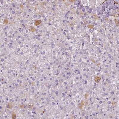 Immunohistochemistry-Paraffin: Apolipoprotein A-IV/ApoA4 Antibody [NBP1-86164]