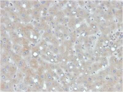 Immunohistochemistry-Paraffin: Apolipoprotein B/ApoB Antibody (APOB/4333) - Azide and BSA Free [NBP3-08230]