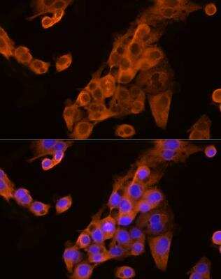 Immunocytochemistry/ Immunofluorescence: Apolipoprotein CIII Antibody - Azide and BSA Free [NBP2-92734]