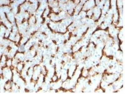 Immunohistochemistry-Paraffin: Apolipoprotein D Antibody (APOD/3413) [NBP3-13946]