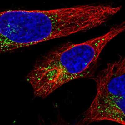Immunocytochemistry/ Immunofluorescence: Apolipoprotein E/ApoE Antibody [NBP2-49450]