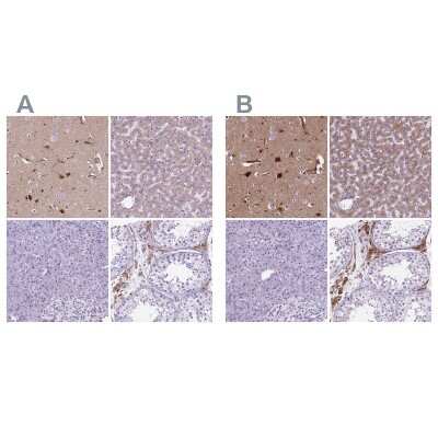 Immunohistochemistry-Paraffin: Apolipoprotein E/ApoE Antibody [NBP2-49450]