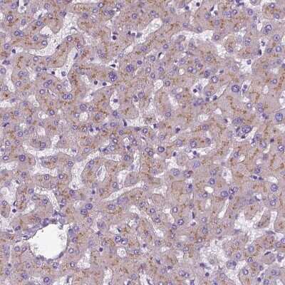Immunohistochemistry-Paraffin: Apolipoprotein E/ApoE Antibody [NBP2-49450]