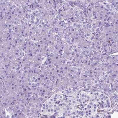 Immunohistochemistry-Paraffin: Apolipoprotein E/ApoE Antibody [NBP2-49450]