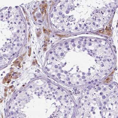Immunohistochemistry-Paraffin: Apolipoprotein E/ApoE Antibody [NBP2-49450]