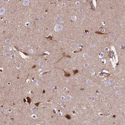 Immunohistochemistry-Paraffin: Apolipoprotein E/ApoE Antibody [NBP2-49450]