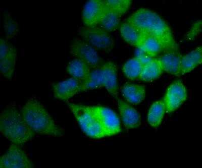 Immunocytochemistry/ Immunofluorescence: Apolipoprotein E R2/ApoE R2 Antibody [NBP2-76911]