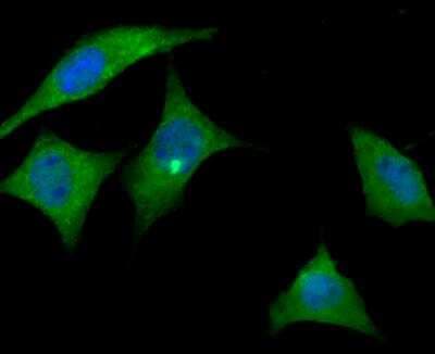 Immunocytochemistry/ Immunofluorescence: Apolipoprotein E R2/ApoE R2 Antibody [NBP2-76911]