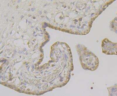 Immunohistochemistry: Apolipoprotein E R2/ApoE R2 Antibody [NBP2-76911]