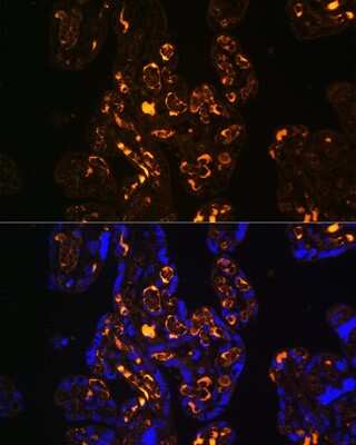 Immunohistochemistry: Apolipoprotein E R2/ApoE R2 Antibody - BSA Free [NBP2-92026]