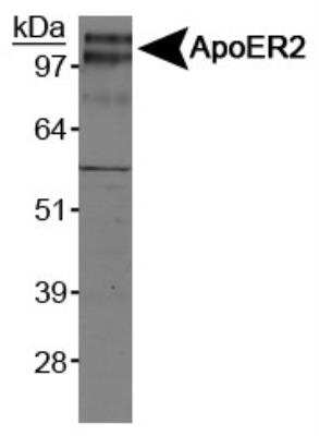 Western Blot: Apolipoprotein E R2/ApoE R2 Antibody [NB100-2216]