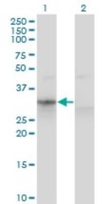 Western Blot: Apolipoprotein F Antibody (1D5) [H00000319-M02]