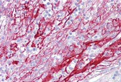 Immunohistochemistry-Paraffin: Apolipoprotein H/ApoH Antibody [NBP1-56310]