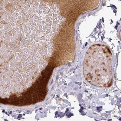 Immunohistochemistry-Paraffin: Apolipoprotein L1 Antibody (CL0171) [NBP2-14785]