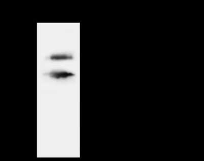 Immunoprecipitation: Apolipoprotein L2 Antibody [NBP2-98660]