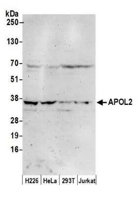 Western Blot: Apolipoprotein L2 Antibody [NBP2-59086]