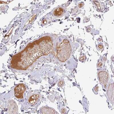 Immunohistochemistry-Paraffin: Apolipoprotein M/ApoM Antibody [NBP2-48991]