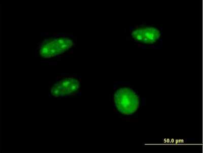 Immunocytochemistry/ Immunofluorescence: Aprataxin Antibody [H00054840-B01P]