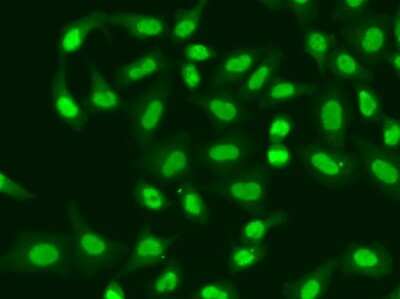 Immunocytochemistry/ Immunofluorescence: Aprataxin Antibody - BSA Free [NBP2-92693]