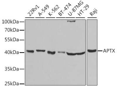 Western Blot: Aprataxin AntibodyBSA Free [NBP2-92693]