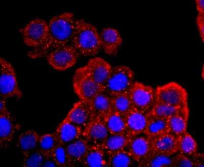 Immunocytochemistry/ Immunofluorescence: Aquaporin 1/AQP1 Antibody (JM10-98) [NBP2-67162]
