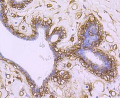 Immunohistochemistry-Paraffin: Aquaporin 1/AQP1 Antibody (JM10-98) [NBP2-67162]