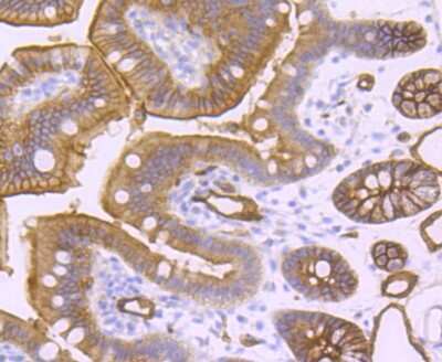 Immunohistochemistry-Paraffin: Aquaporin 1/AQP1 Antibody (JM10-98) [NBP2-67162]