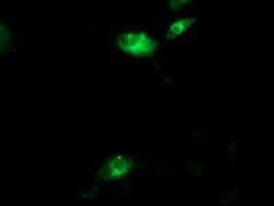Immunocytochemistry/ Immunofluorescence: Aquaporin 1/AQP1 Antibody (OTI2D10) - Azide and BSA Free [NBP2-70199]