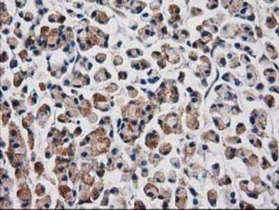 Immunohistochemistry: Aquaporin 1/AQP1 Antibody (OTI2D10) - Azide and BSA Free [NBP2-70199]