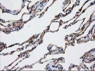 Immunohistochemistry: Aquaporin 1/AQP1 Antibody (OTI2D10) - Azide and BSA Free [NBP2-70199]